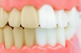 Liquide dentifrice contre la mauvaise haleine.